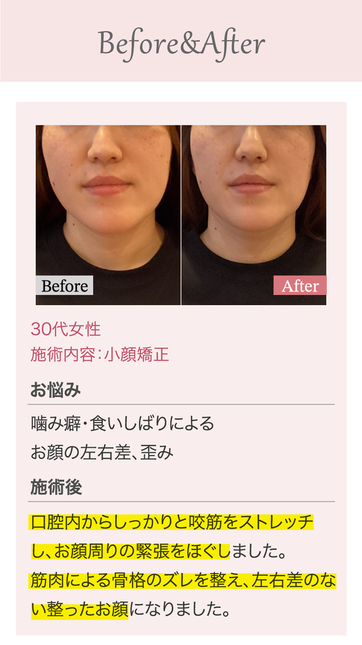 たるみ＆美肌専門サロンPlus Belle