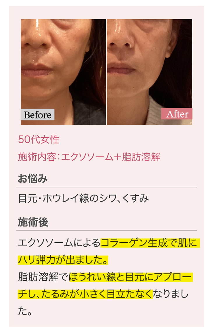 たるみ＆美肌専門サロンPlus Belle