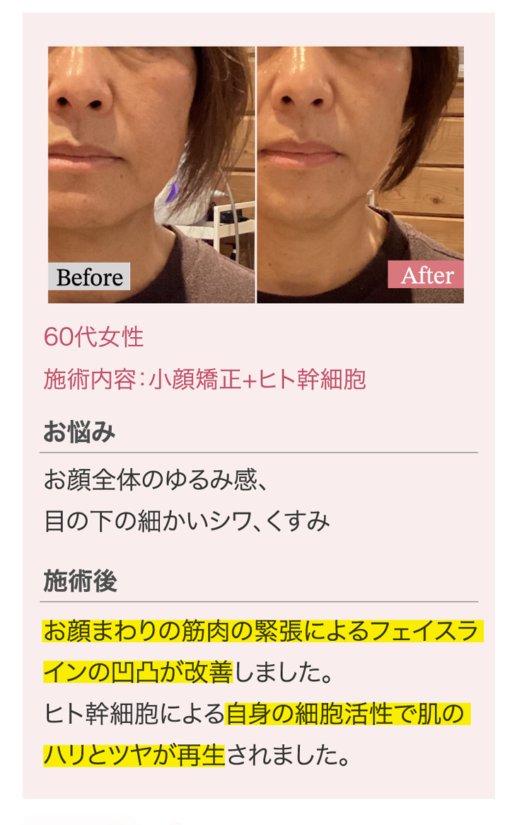 たるみ＆美肌専門サロンPlus Belle